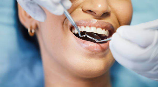 Best Emergency Tooth Extraction in Wildwood, NJ